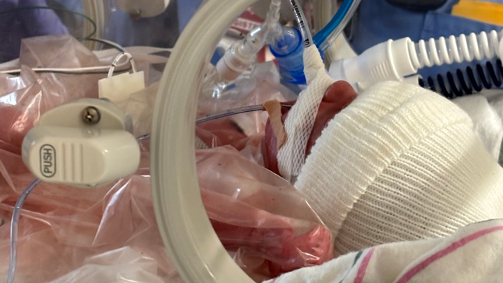 Help Baby Wesley & His Parents Through This Difficult Time campaign photo, 1 of 6