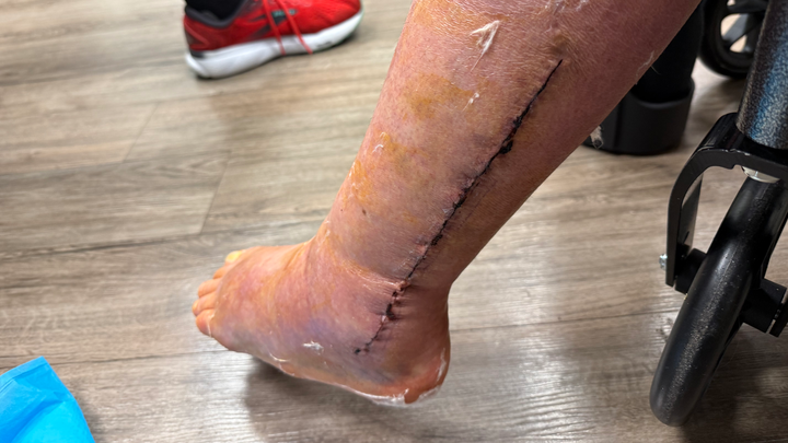 Help : monthly & medical campaign photo, 1 of 6