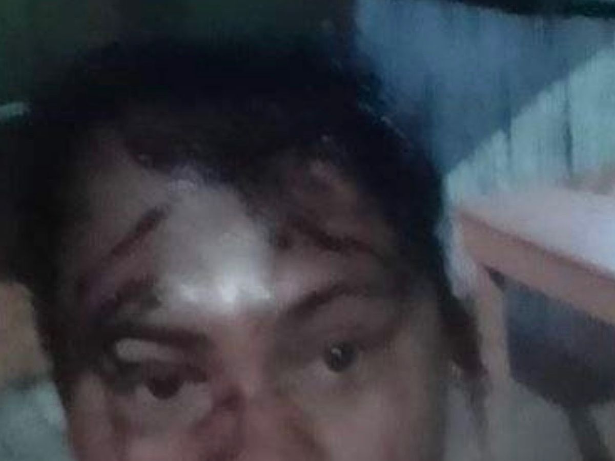 Foto de la recaudación de fondos Ayuda a Arcenia a estar a salvo , 1 de 5