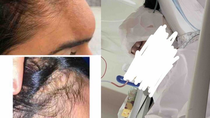 Foto della campagna Support to recover from Bone tumor surgery, 1 di 3