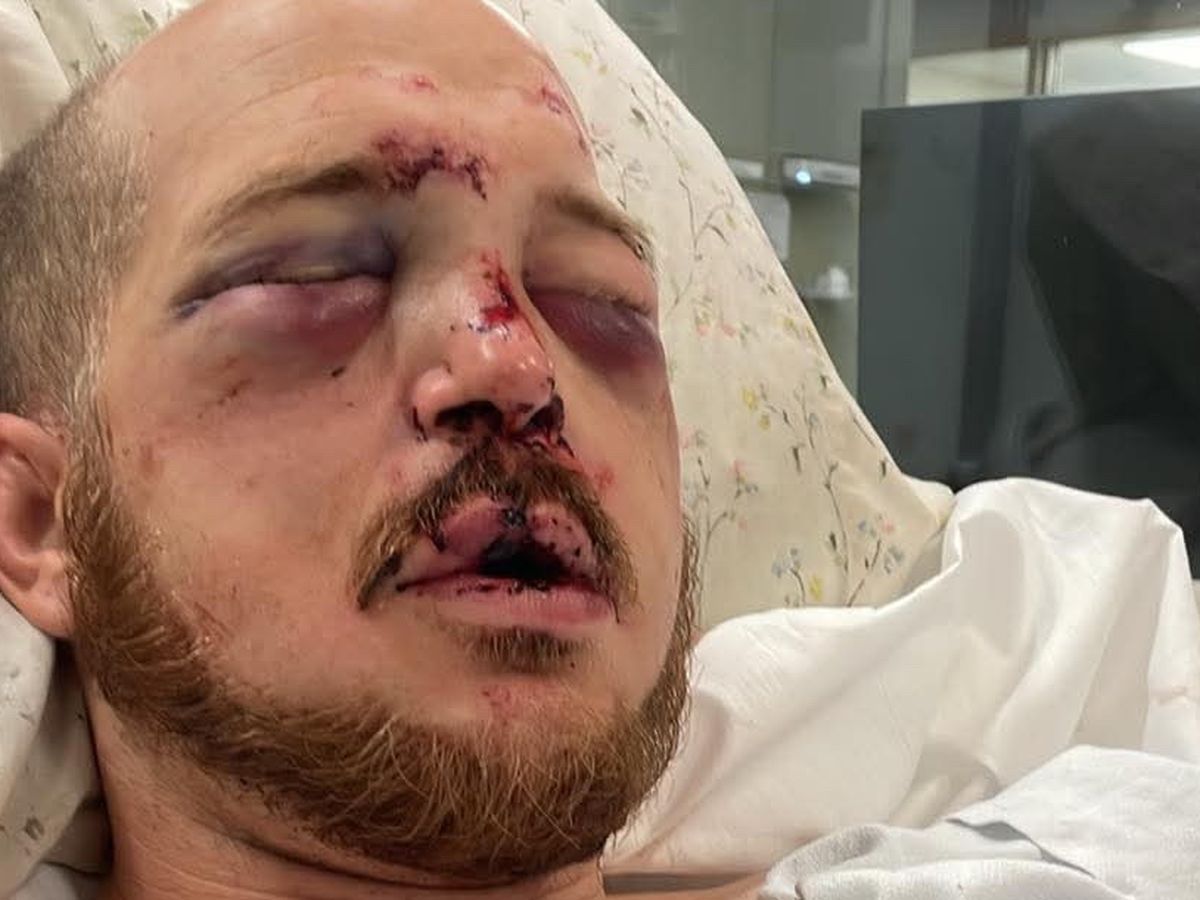 Support for Brother-in-Law’s Recovery After Attack campaign photo, 1 of 8