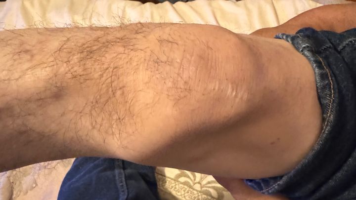 Help Tito Get the Knee Surgery He Needs campaign photo, 1 of 5