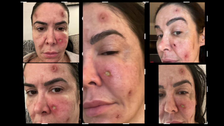 Donate to help me recovery my skin and come back to work! campaign photo, 1 of 8