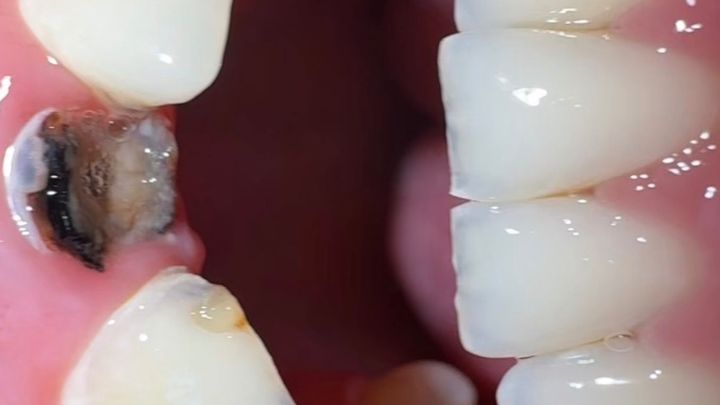 Struggling with dental pain & treatment — no NHS dentist ava campaign photo, 1 of 5