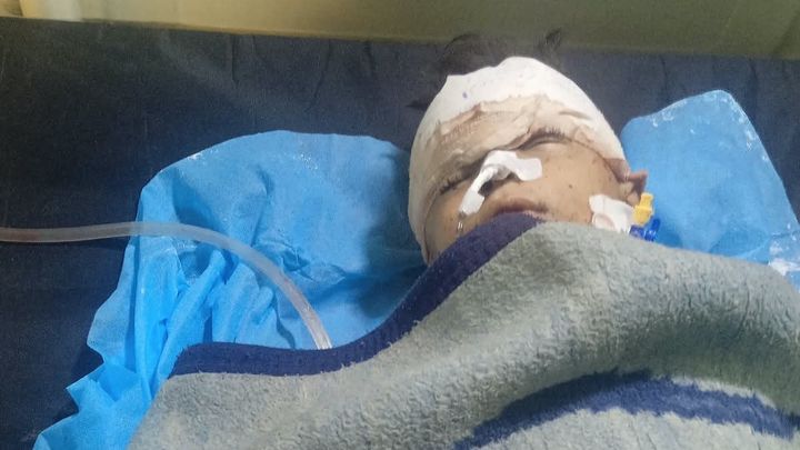 Urgent eye triple surgery and elbow surgery campaign photo, 1 of 5
