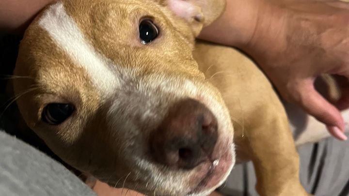 Help Rhea Get Life-Saving Surgery campaign photo, 1 of 3