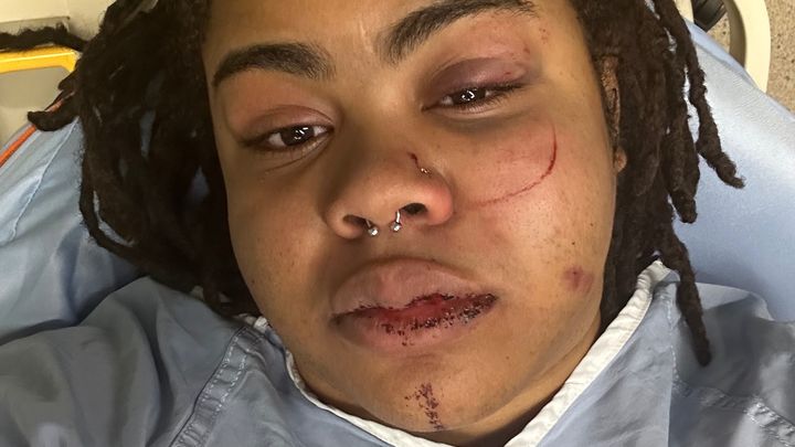 Help Me Recover After a Violent Assault campaign photo, 1 of 8
