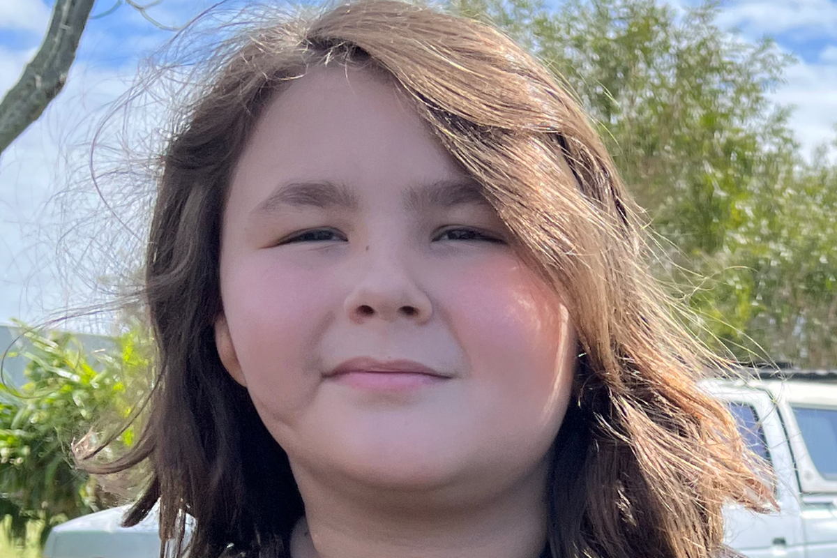 Fundraiser by Tiffany Oliver : Zach's 3D Ear Reconstruction