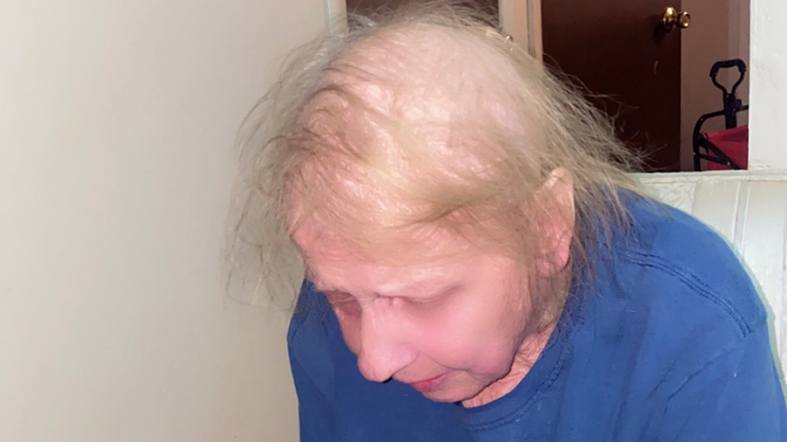 Help Catherine Fight Breast Cancer and Recover After Surgery campaign photo, 1 of 8