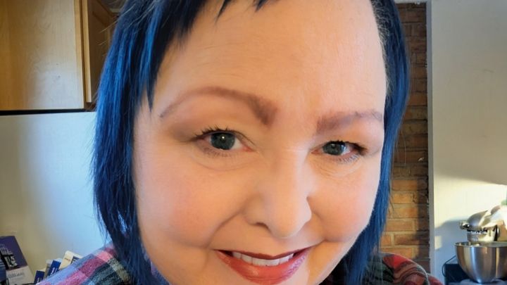 Support Heather’s Surgery and Recovery Time campaign photo, 1 of 3