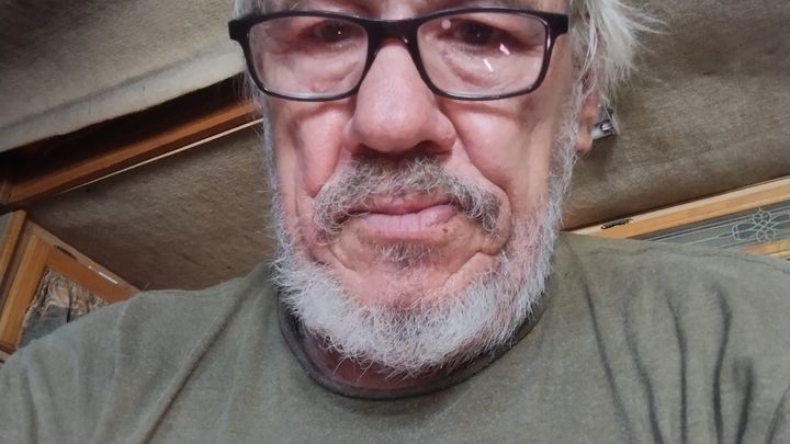 Support Larry’s Journey to Confident Smiles campaign photo, 1 of 4