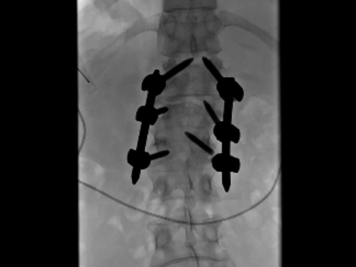 Fundraiser’s main image