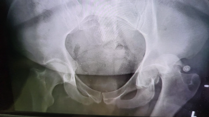 Help Julian Ochoa Recover from Severe Injury campaign photo, 1 of 7