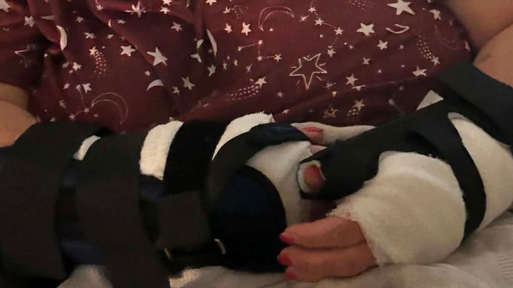 Supporting Angie While Recovering From Dog Attack campaign photo, 1 of 5