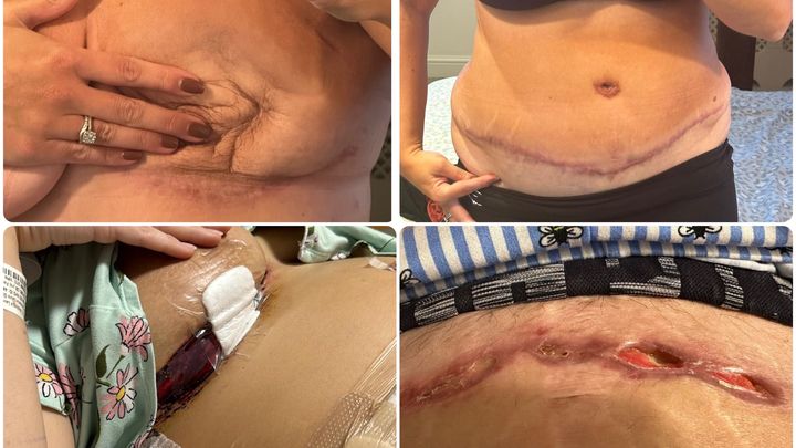 Help Steph Restore Her Life After Cancer and Failed Surgery campaign photo, 1 of 2