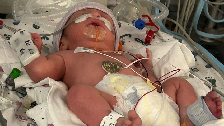 Help me improve my health (NICU) campaign photo, 1 of 6
