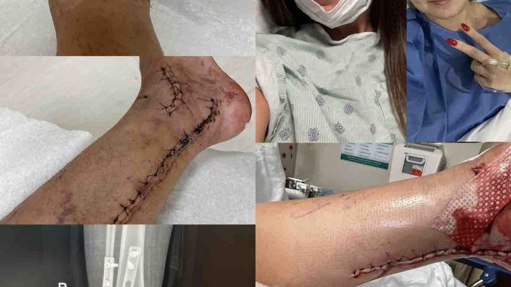 Foto de la recaudación de fondos Nadia's ER and second surgery support, 1 de 2