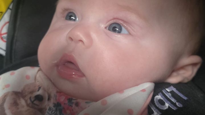 Baby Bonnie’s skull care journey ‘Bonnie’s Wee Bonce’ campaign photo, 1 of 4