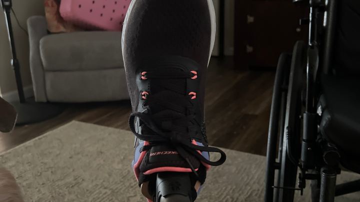 Help Cover the Cost of a Prosthetic Foot campaign photo, 1 of 4