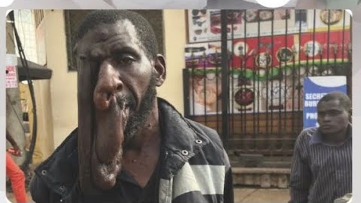 Miniature de vidéo AIDONS IDRISSOU À SE FAIRE OPÉRER DU VISAGE, 1 sur 8
