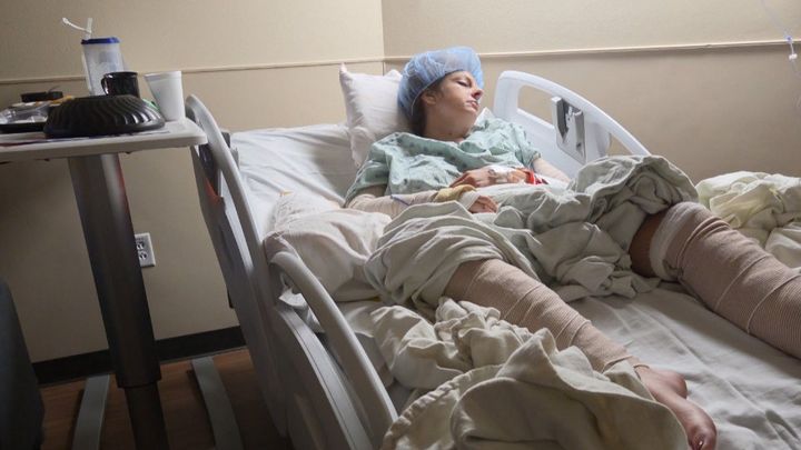 Help Cassie Recover from Dog Attack Injuries campaign photo, 1 of 3