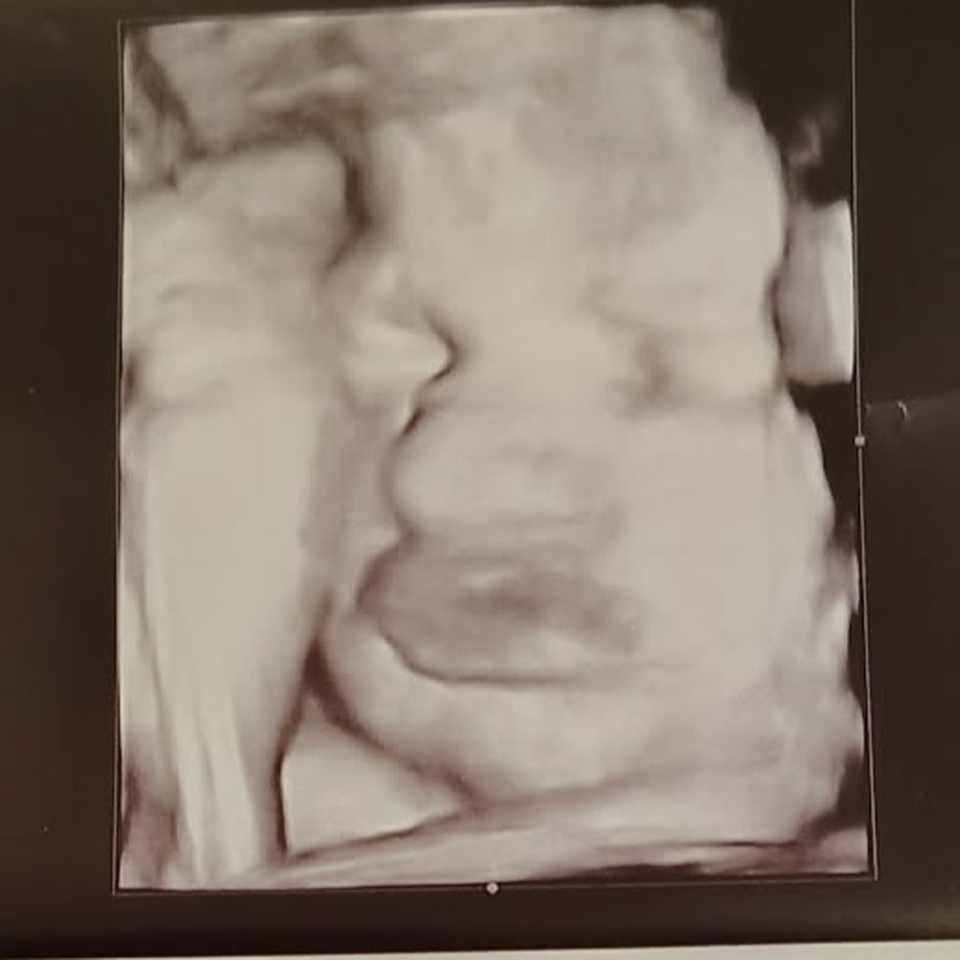 Help Samantha Welcome Her Miracle Baby