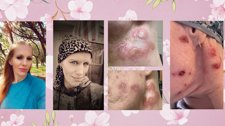 Support for My Ongoing Medical Journey campaign photo, 1 of 4