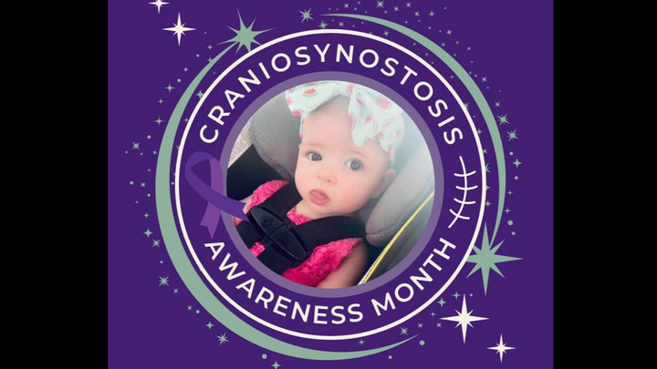 Donate for Daniella's Life-Changing Surgery campaign photo, 1 of 7
