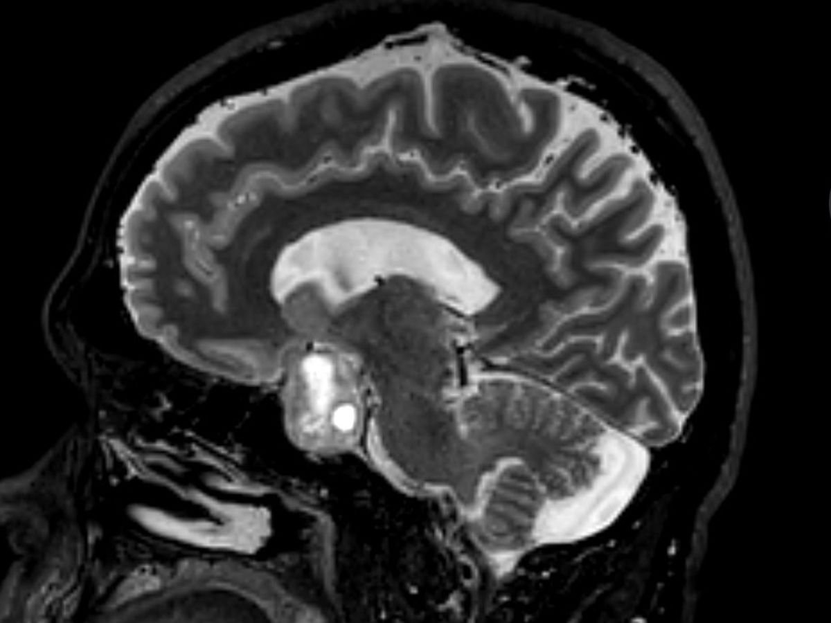 Fundraiser’s main image