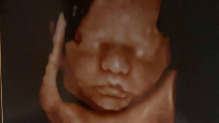 Stand with Layla in Her Fight Against CDH campaign photo, 1 of 6