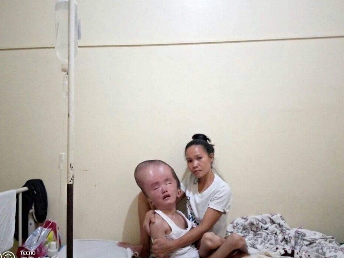 Fundraiser By ヘドマルク ルディー リン Mark Padernal Hydrocephalus Patient