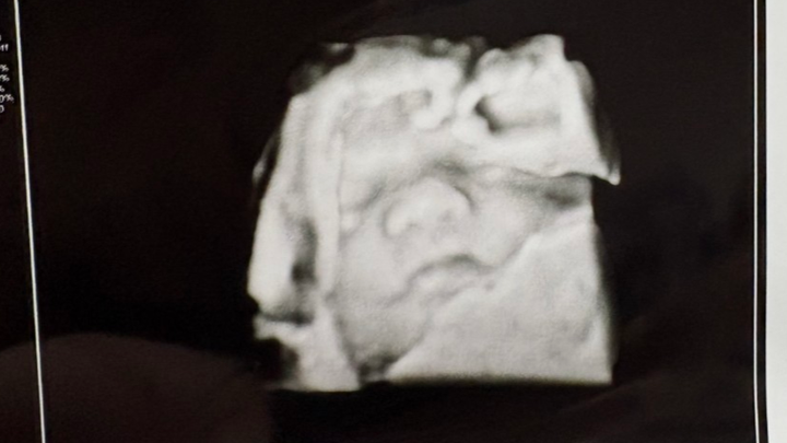 Support Sidney, Donald, and Baby Oakleigh's Journey campaign photo, 1 of 7