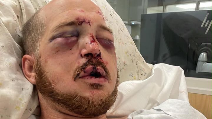 Support for Brother-in-Law’s Recovery After Attack campaign photo, 1 of 8
