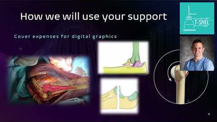 Miniatura del video Education for future Shoulder and Elbow Surgeons, 1 di 3