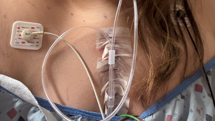 Support Marilyn Sanchez's Heart Recovery Journey campaign photo, 1 of 3