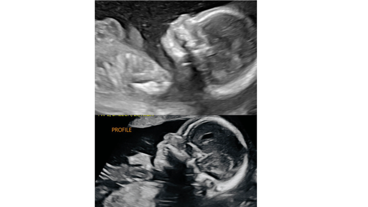 Standing with Paige and Lucas for Their Twins campaign photo, 1 of 8