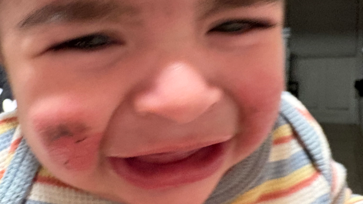 help get my baby an eczema treatment campaign photo, 1 of 6