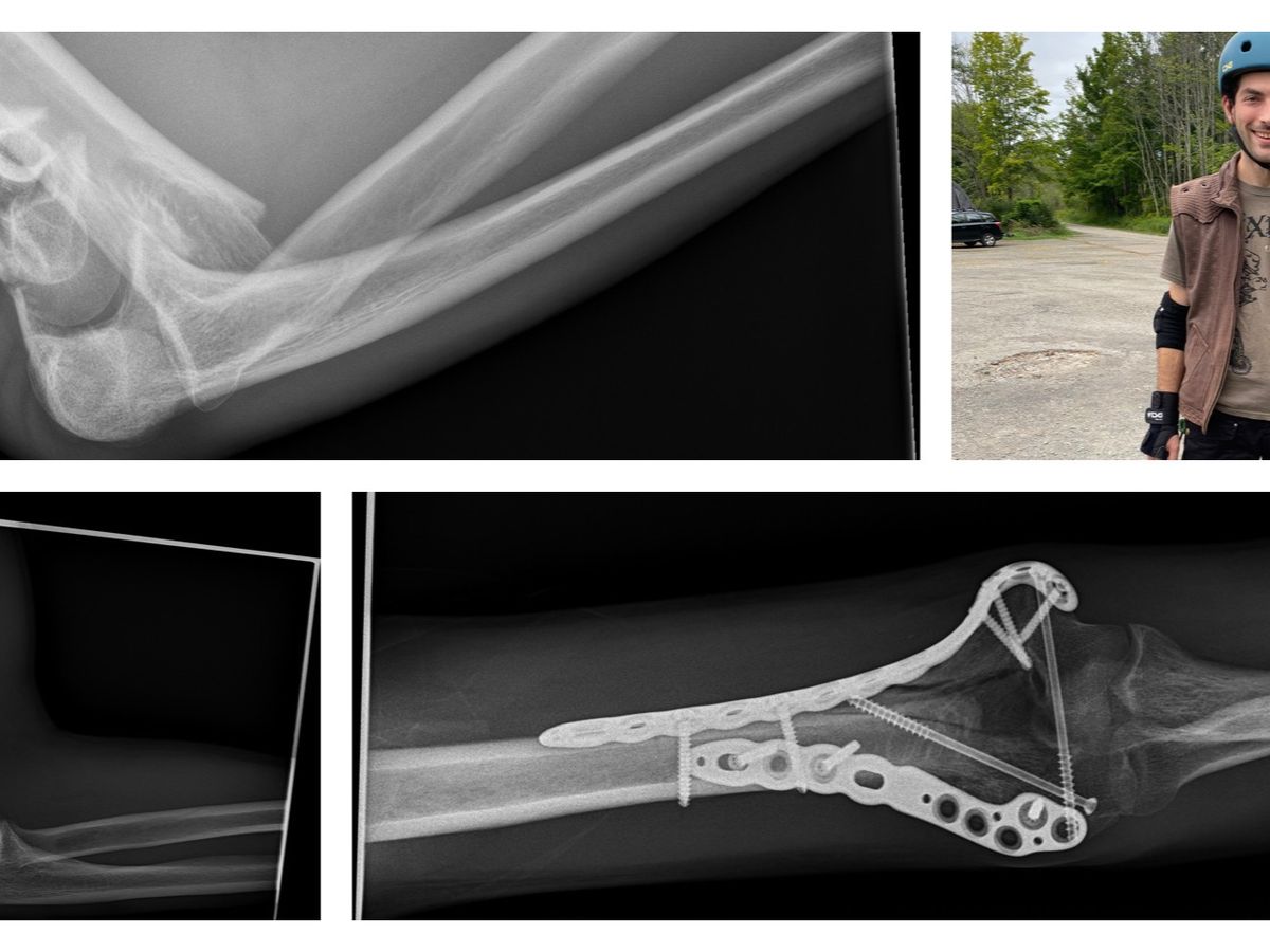 Fundraiser by Josh Rinaldi : Josh Rinaldi is hurt and needs our help!