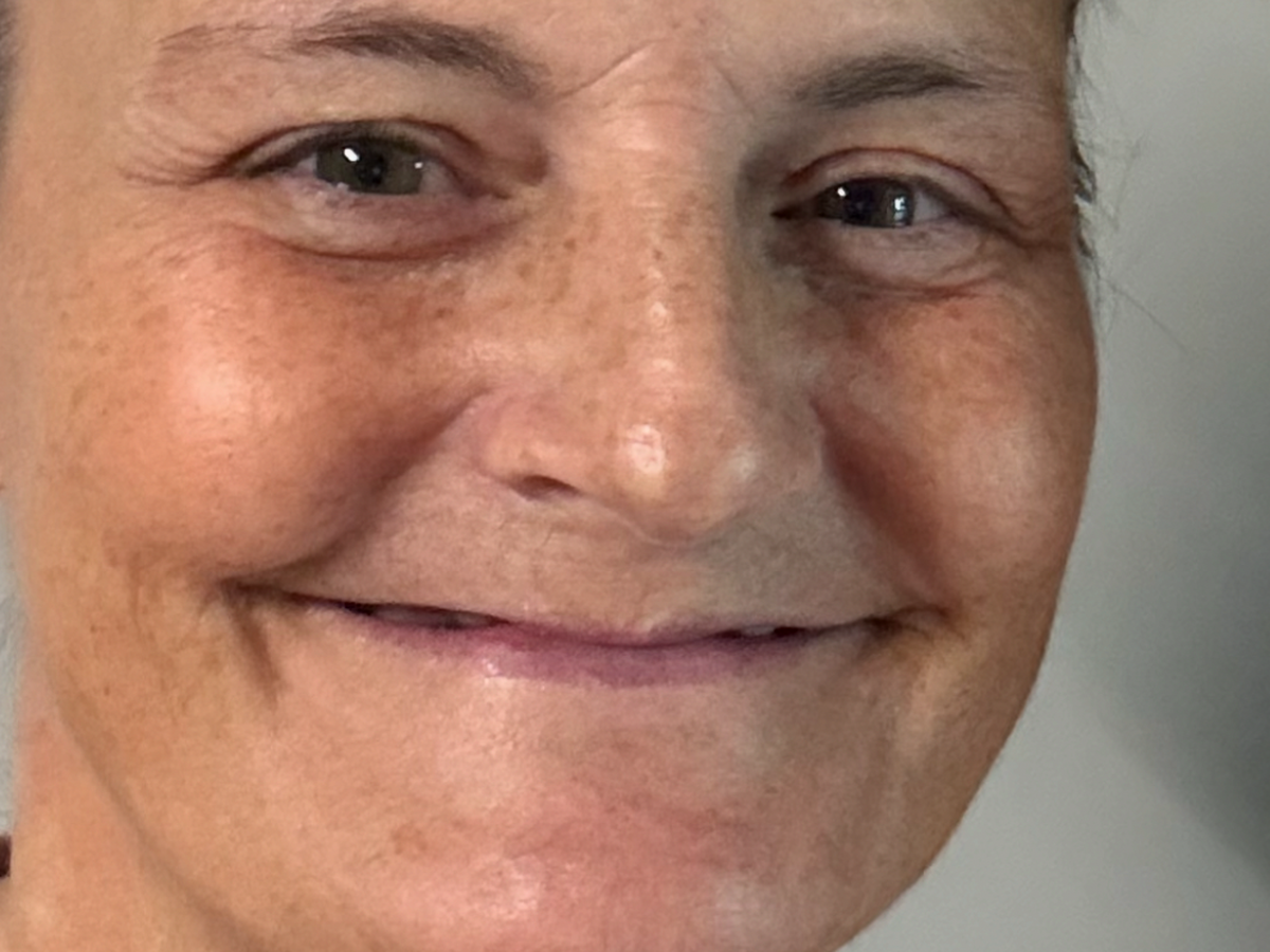 Tooth Extractin Fundraiser by Toni Edwards : Dental Extractions and Smile Recovery