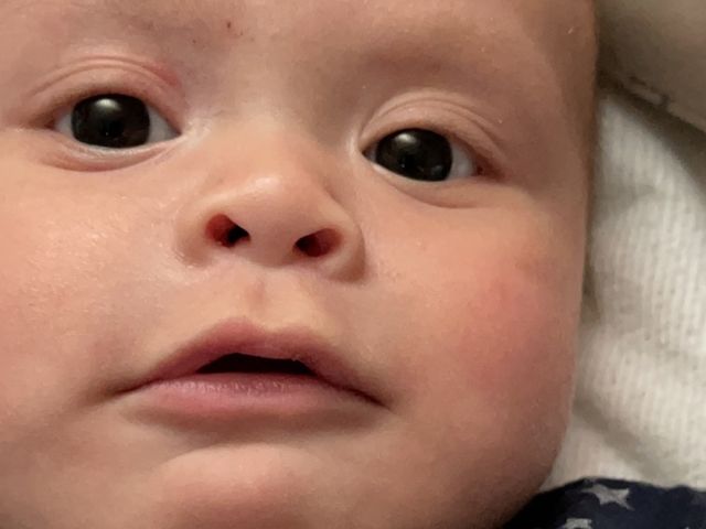 Fundraiser By Gracie Mata Baby Aiden Helmet