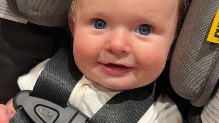 Baby Cillian's Fight With Retinoblastoma campaign photo, 1 of 7