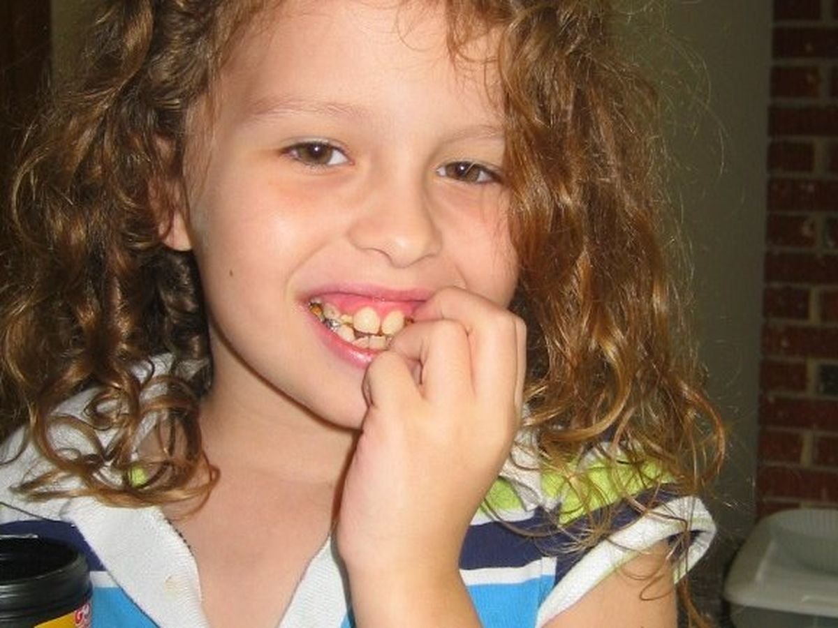 Let's Get Savannah Teeth campaign photo, 1 of 4