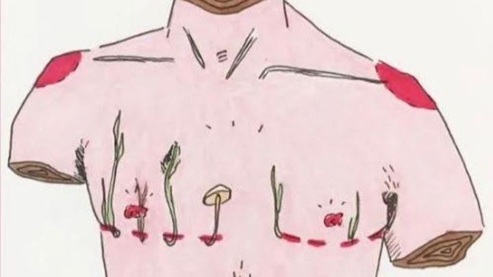 Campaña de Zeynep Kiyak : Mastectomy Solidarity Fund!