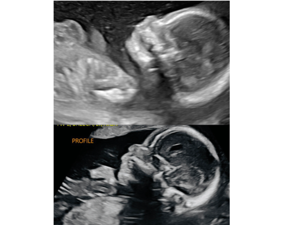Fundraiser’s main image