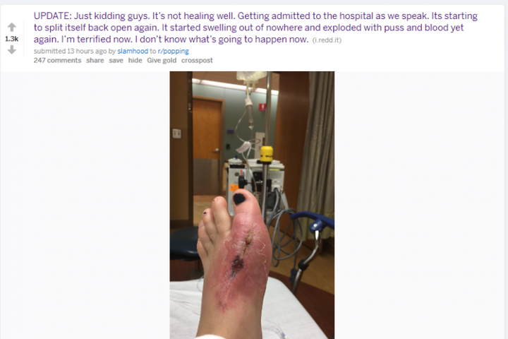 Fundraiser For Stacey Hood By Nemo Philist Slamhood S Medical Bills Fund