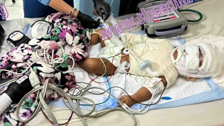 Save Baby Liana campaign photo, 1 of 8