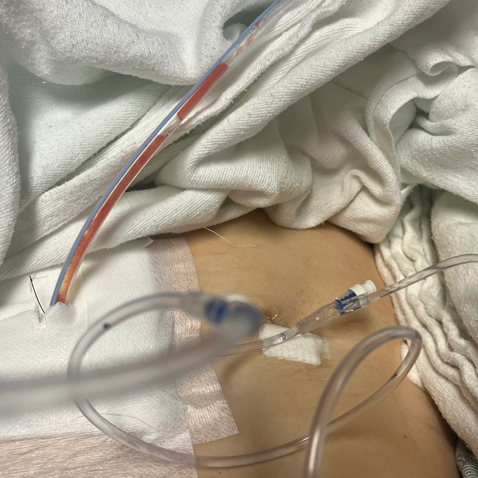 Mom that needs help after emergency surgery