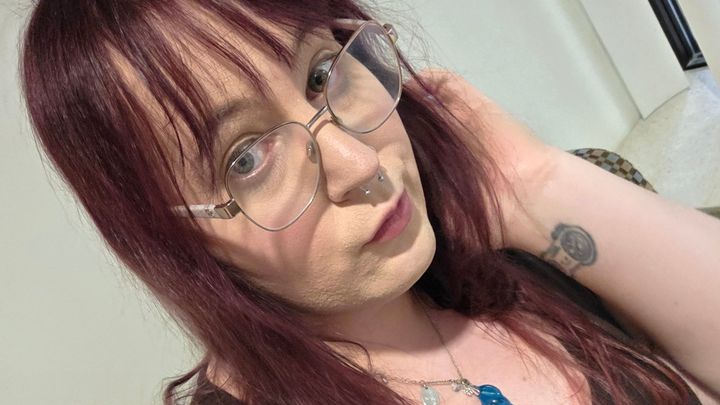 Support Allison’s Gender-Affirming Surgery Recovery campaign photo, 1 of 7
