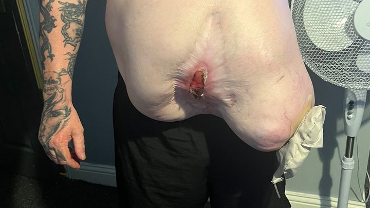 Help raise money for life saving hernia operation campaign photo, 1 of 6