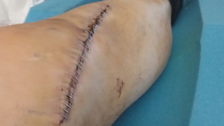 Help Me Recover After Being Hit by a Truck campaign photo, 1 of 5